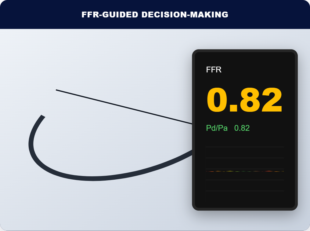 The FFR Paradox: Why the Gold Standard Isn’t the Standard Everywhere