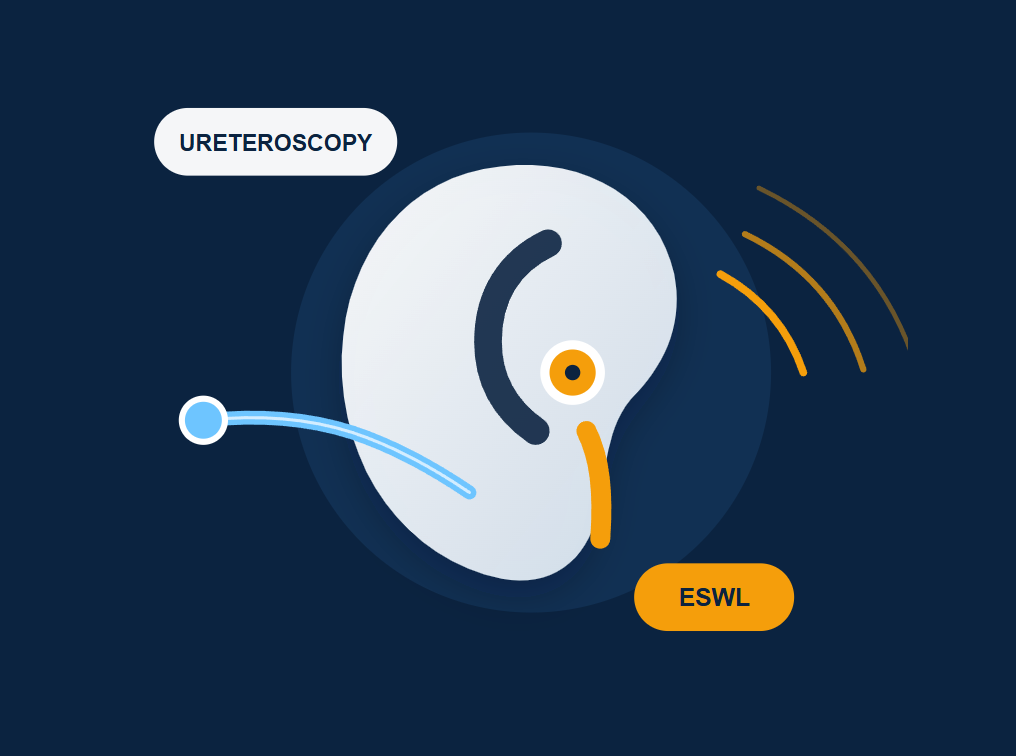The Stone Wars: Why ESWL Isn’t Going Away